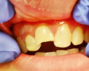 family dentistry